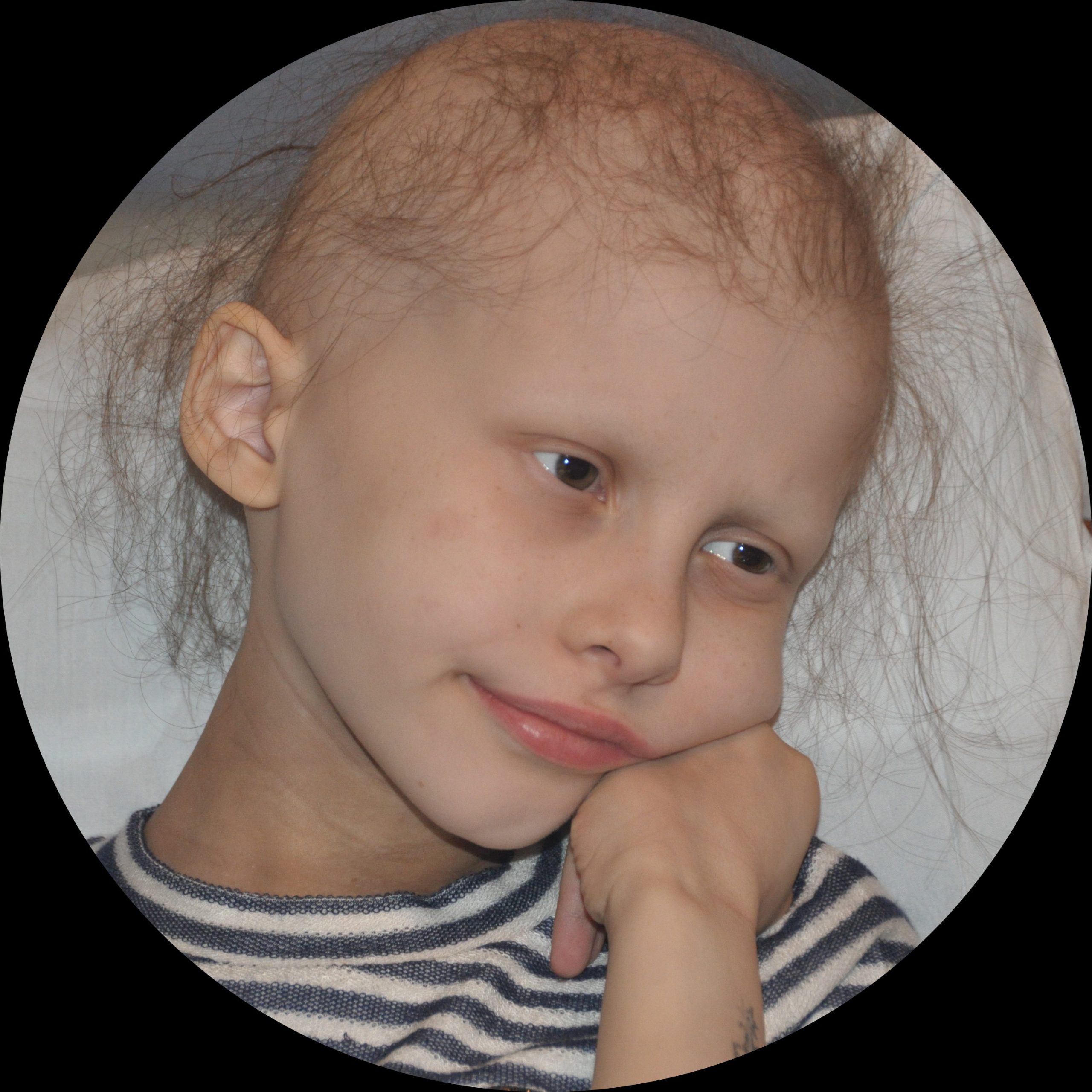 Elana during treatment